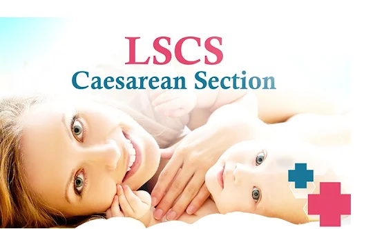 Caesarean Section Multiple Previous LSCS